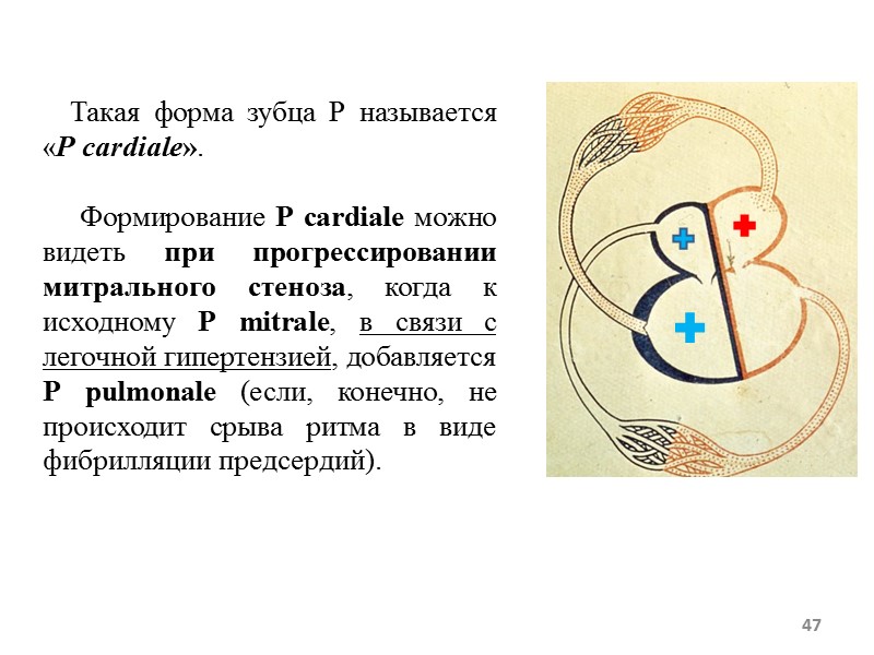 47 Такая форма зубца Р называется «Р cardiale». 47 Такая форма зубца Р называется «Р cardiale».